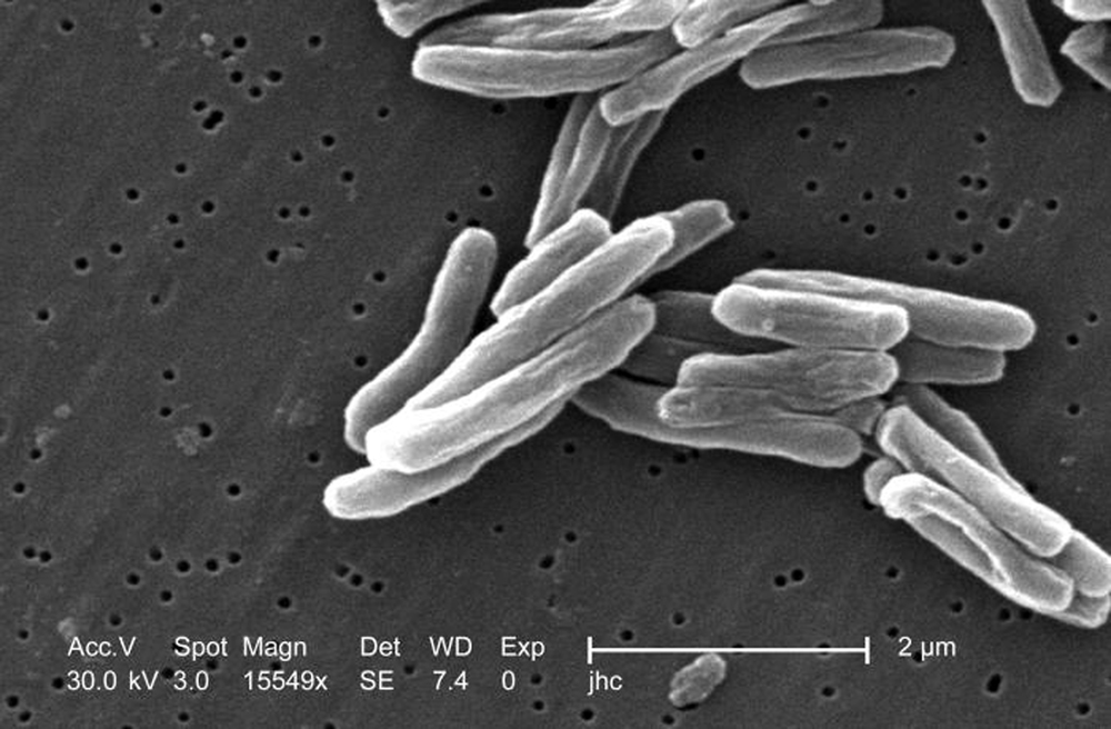 Tuberkelbakterien unter dem Mikroskop