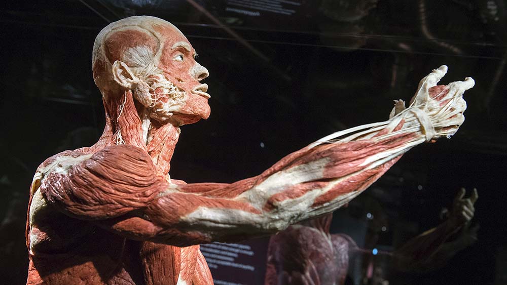 Die Plastinate sind sehr umstritten