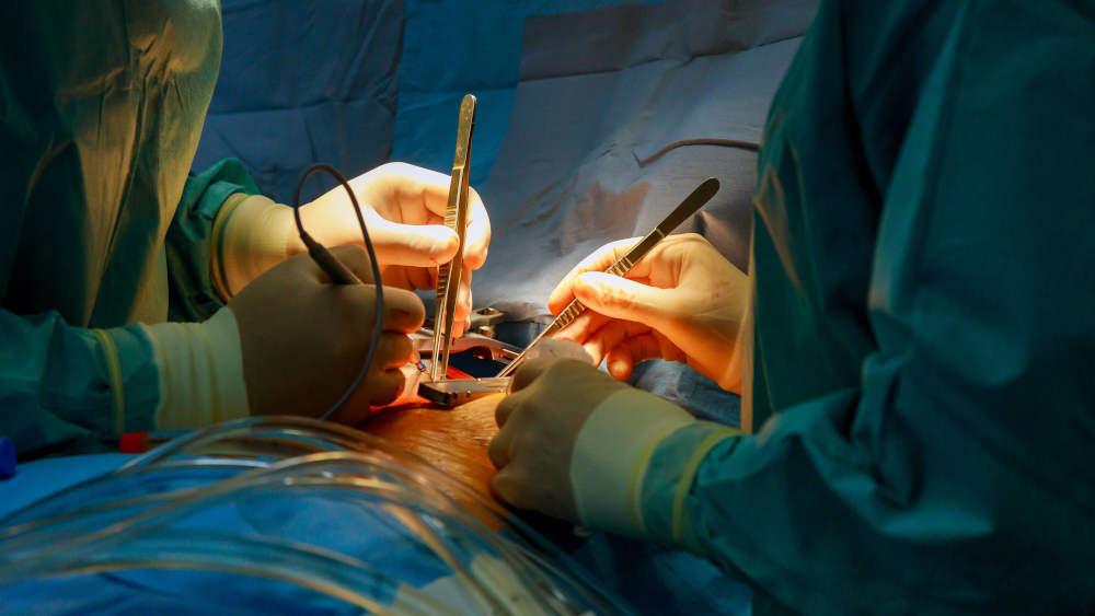 Image - Organspende: Ist der Hirntod der falsche Tod?