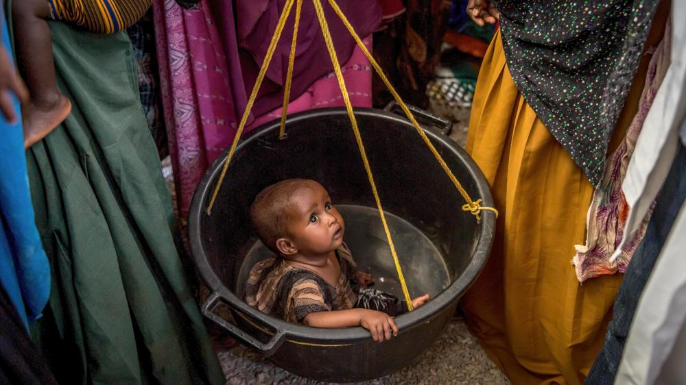 Ein Kind wird auf Unterernährung getestet in Baidoa, Somalia