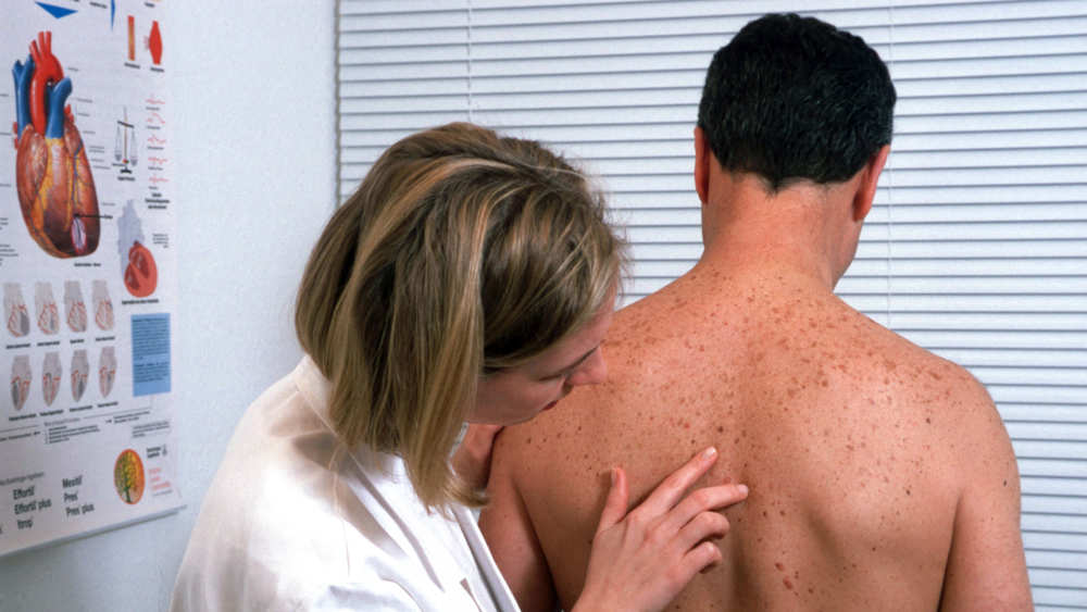 2021 gab es nach Zahlen der Deutschen Krebshilfe 41.360 maligne Melanome. 2023 werden es nach einer Prognose rund 42.300 sein