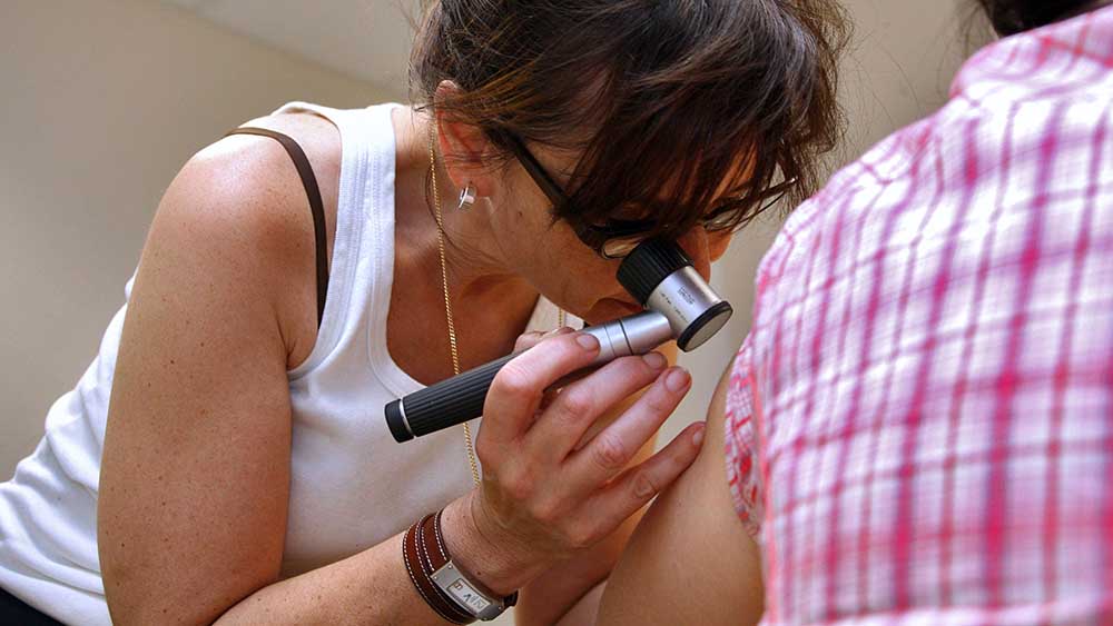 Alle zwei Jahre übernimmt die Krankenkasse eine Hautkrebsvorsorge