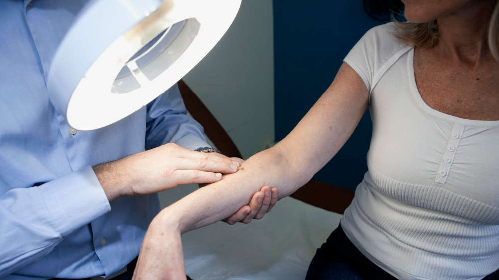 Image - Krankenkasse: Nur wenig Berechtigte gehen zum Hautkrebs-Screening