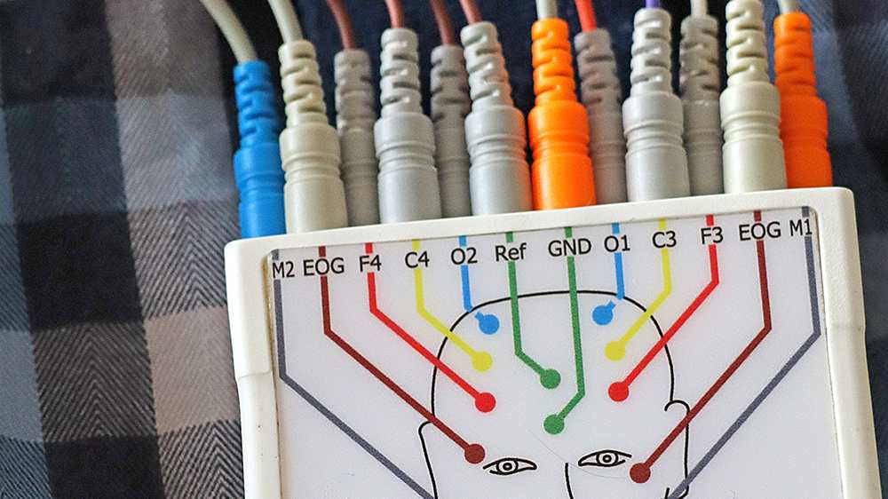 Eine Karte bündelt die Karten der Elektroden und zeigt an, welche auf welcher Partie des Gesichts klebt