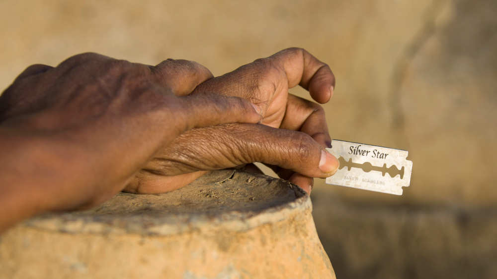 Mit einer Rasierklinge und meist ohne Betäubung wird die Beschneidung durchgeführt