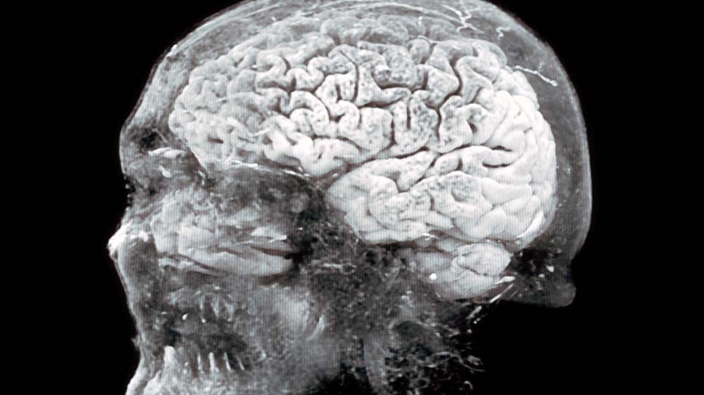 Das menschliche Gedächtnis ist viel mehr als ein Wissensspeicher